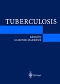 Cover: Tuberculosis - Springer