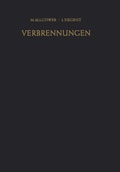 Cover: Verbrennungen - Springer