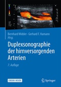 Abbildung von: Duplexsonographie der hirnversorgenden Arterien - Springer