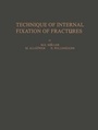 Cover: Technique of Internal Fixation of Fractures - Springer