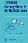 Cover: Osteosynthese in der Handchirurgie - Springer