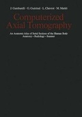 Cover: Computerized Axial Tomography - Springer