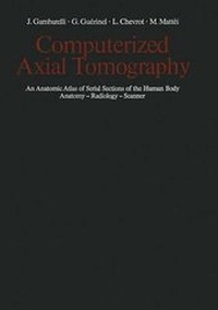 Enlarge image Cover: Computerized Axial Tomography - Springer