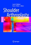 Cover: Shoulder Arthroplasty - Springer