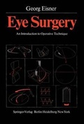 Cover: Eye Surgery - Springer