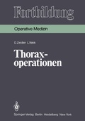 Bild: Thoraxoperationen - Springer