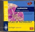 Cover: Leukemias - Springer