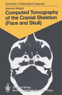 Abbildung von: Computed Tomography of the Cranial Skeleton (Face and Skull) - Springer