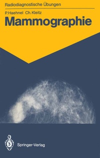 Abbildung von: Mammographie - Springer