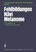 Cover: Fehlbildungen N&auml;vi Melanome - Springer