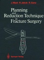Cover: Planning and Reduction Technique in Fracture Surgery - Springer