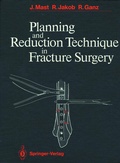 Cover: Planning and Reduction Technique in Fracture Surgery - Springer