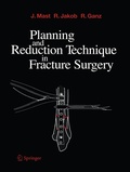 Cover: Planning and Reduction Technique in Fracture Surgery - Springer