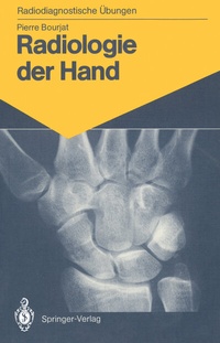 Abbildung von: Radiologie der Hand - Springer