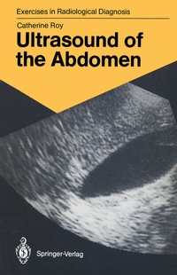 Abbildung von: Ultrasound of the Abdomen - Springer