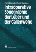 Cover: Intraoperative Sonographie der Leber und der Gallenwege - Springer