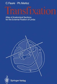 Enlarge image Cover: Transfixation - Springer