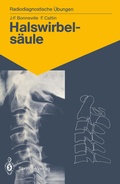 Cover: Halswirbels&auml;ule - Springer
