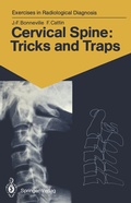 Cover: Cervical Spine: Tricks and Traps - Springer