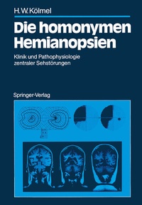 Abbildung von: Die homonymen Hemianopsien - Springer