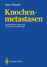 Abbildung von: Knochenmetastasen - Springer