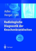 Cover: Radiologische Diagnostik der Knochenkrankheiten - Springer
