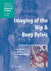 Abbildung von: Imaging of the Hip & Bony Pelvis - Springer