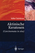 Cover: Aktinische Keratosen (Carcinomata in situ) - Springer