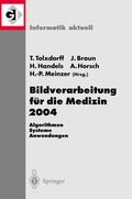 Cover: Bildverarbeitung f&uuml;r die Medizin 2004 - Springer