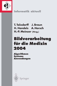 Abbildung von: Bildverarbeitung für die Medizin 2004 - Springer