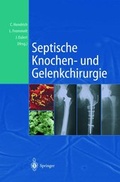 Cover: Septische Knochen-und Gelenkchirurgie - Springer