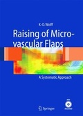 Cover: Raising of Microvascular Flaps - Springer