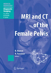 Abbildung von: MRI and CT of the Female Pelvis - Springer