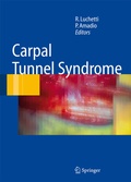 Cover: Carpal Tunnel Syndrome - Springer