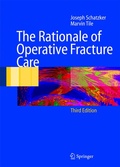 Cover: The Rationale of Operative Fracture Care - Springer