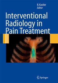 Enlarge image Cover: Interventional Radiology in Pain Treatment - Springer