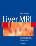 Cover: Liver MRI - Springer