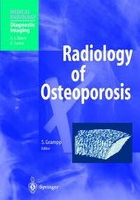 Abbildung von: Radiology of Osteoporosis - Springer