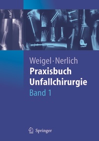 Abbildung von: Praxisbuch Unfallchirurgie - Springer