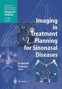 Abbildung von: Imaging in Treatment Planning for Sinonasal Diseases - Springer