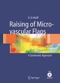 Cover: Raising of Microvascular Flaps - Springer