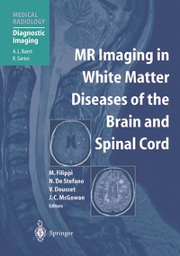 Abbildung von: MR Imaging in White Matter Diseases of the Brain and Spinal Cord - Springer