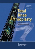 Cover: Total Knee Arthroplasty - Springer