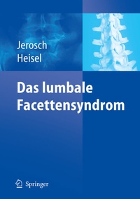 Abbildung von: Das lumbale Facettensyndrom - Springer