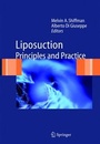 Cover: Liposuction - Springer