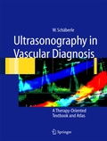 Cover: Ultrasonography in Vascular Diagnosis - Springer
