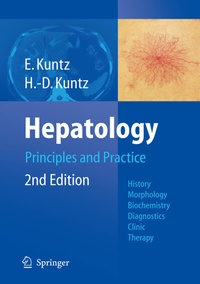 Abbildung von: Hepatology, Principles and Practice - Springer