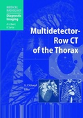 Cover: Multidetector-Row CT of the Thorax - Springer