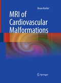 Cover: MRI of Cardiovascular Malformations - Springer
