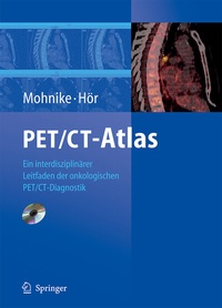 Abbildung von: PET/CT-Atlas - Springer